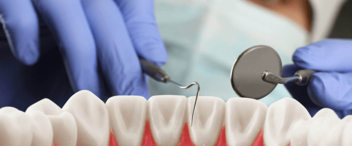 Restorative dentistry at Smile Lounge