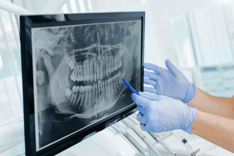 Oral Cancer Screening at Smile Lounge
