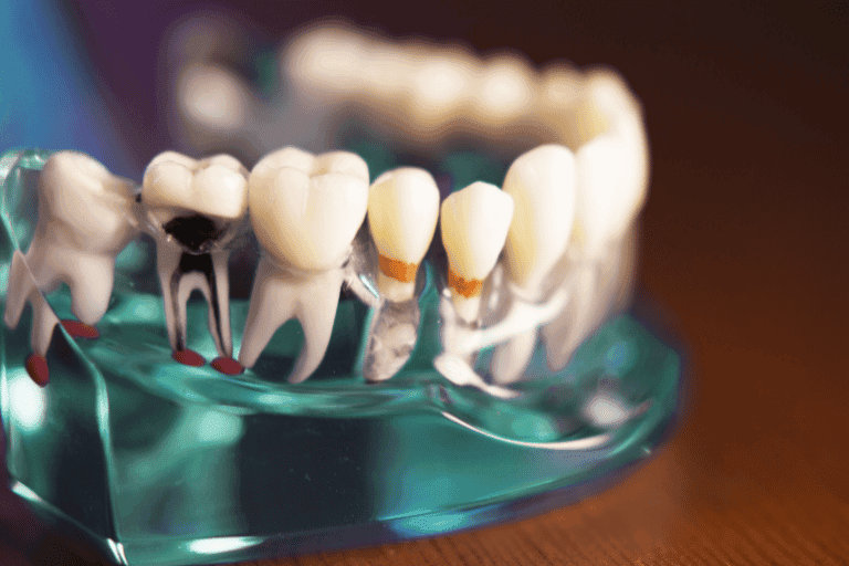 Cosmetic dentistry at Smile Lounge Dentistry in Milton
