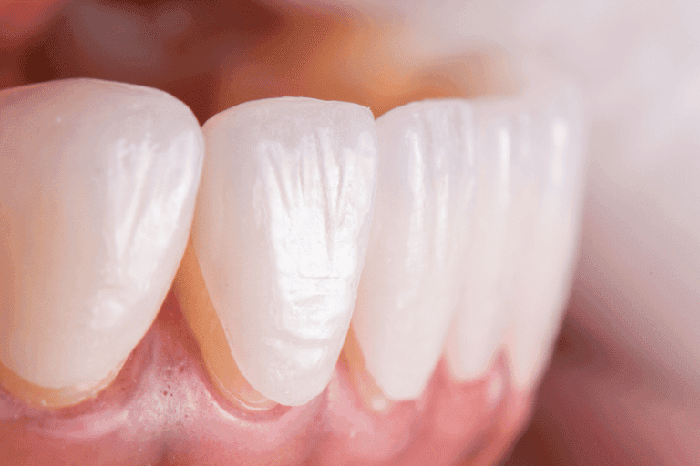 Cosmetic dentistry at Smile Lounge Dentistry in Milton