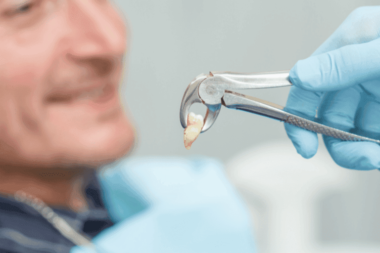 Teeth extraction at Smile Lounge Dentistry in Milton