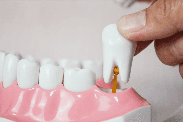 Teeth extraction at Smile Lounge Dentistry in Milton