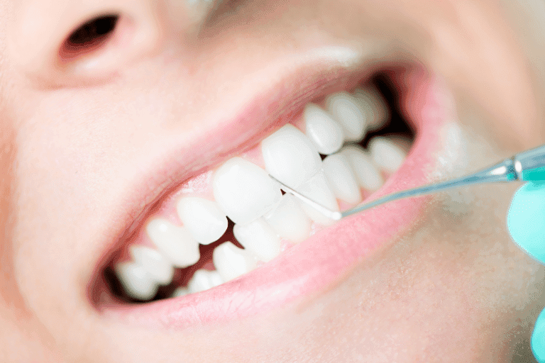 Dental cleaning procedure at Smile Lounge