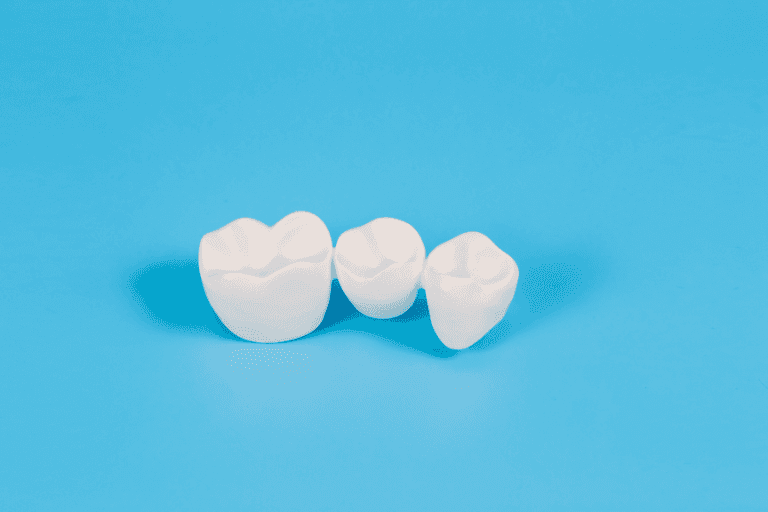 Dental Crowns at Smile Lounge