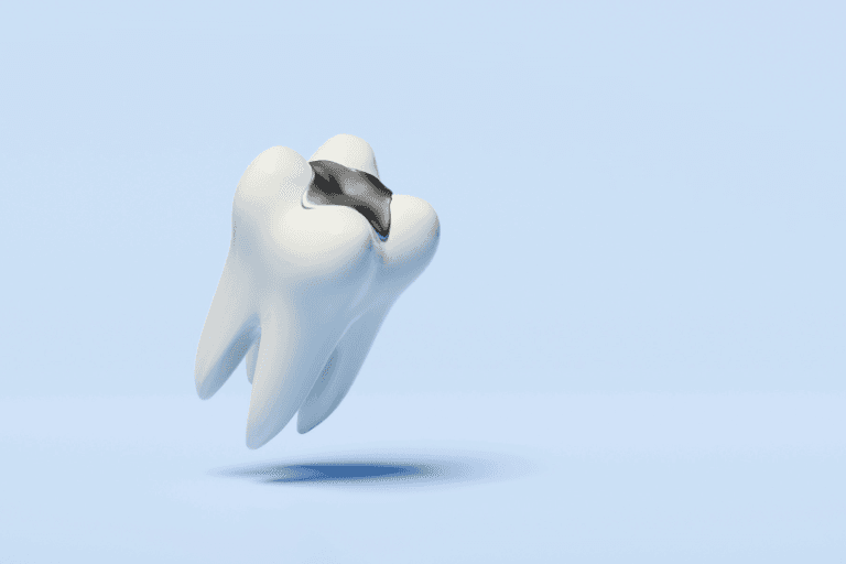 Dental Fillings at Smile Lounge