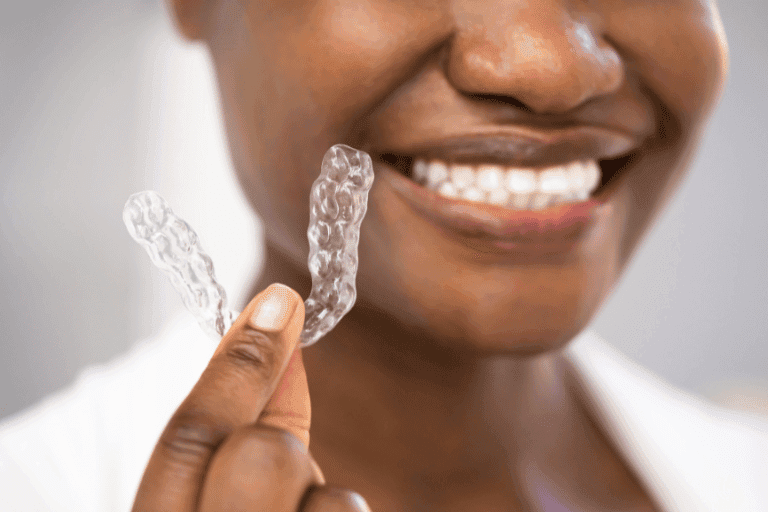 Dental Mouth Guards at Smile Lounge