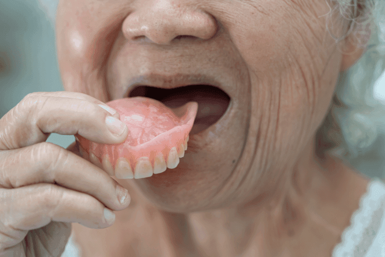Dentures at Smile Lounge