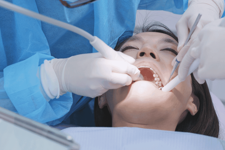 Flouride Treatments at Smile Lounge