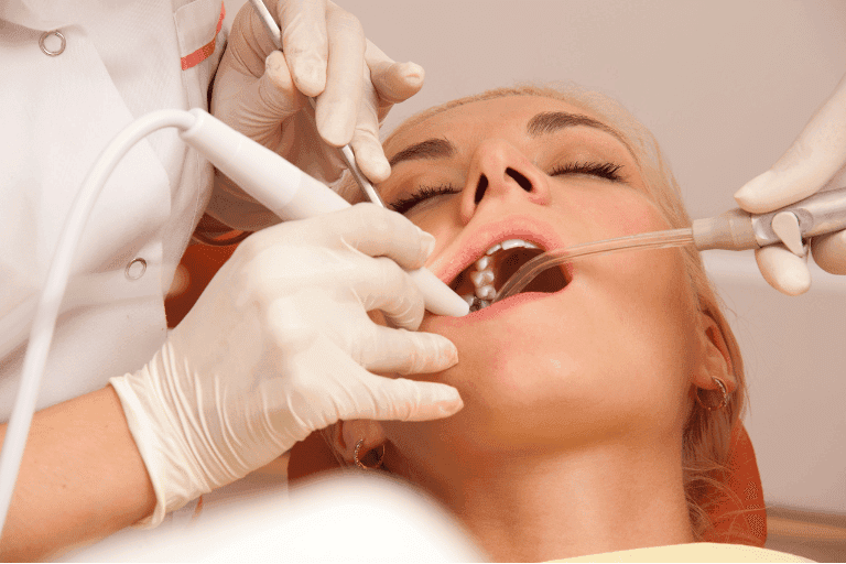 Flouride Treatments at Smile Lounge