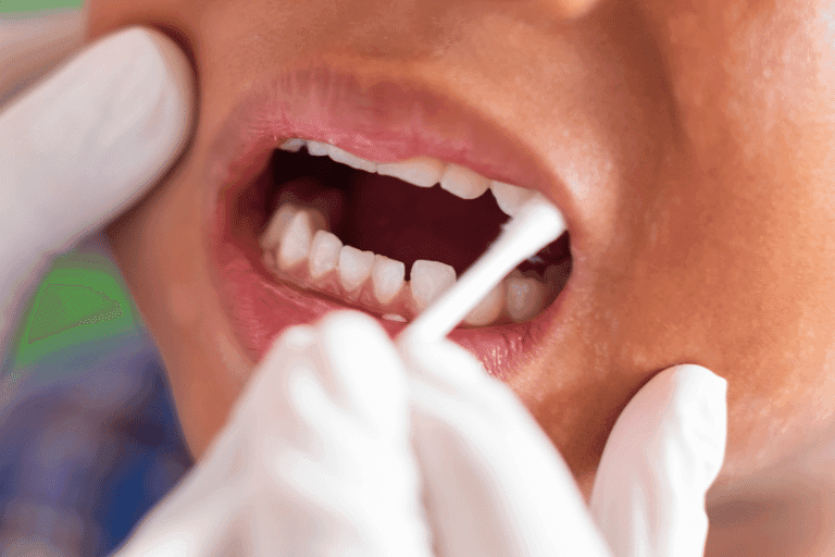 Flouride Treatments at Smile Lounge