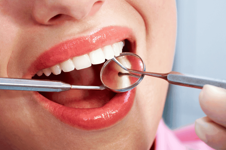 Flouride Treatments at Smile Lounge