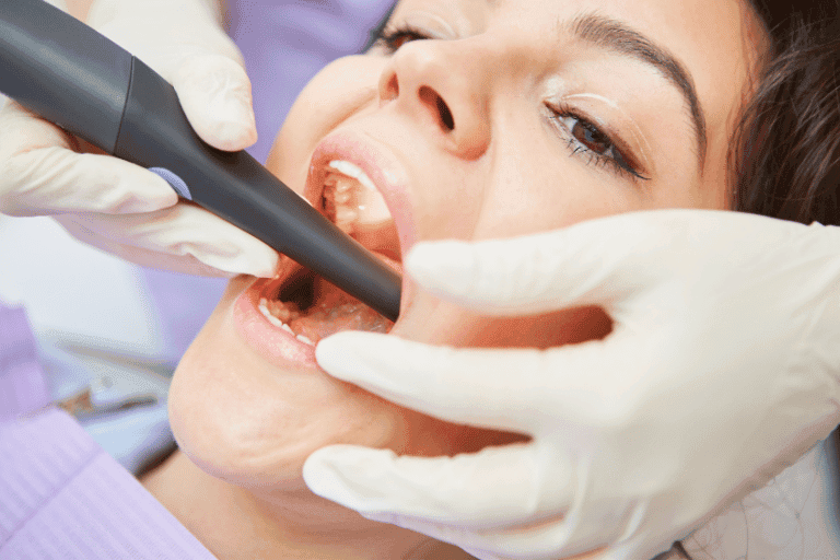 Root Canal Treatment at Smile Lounge