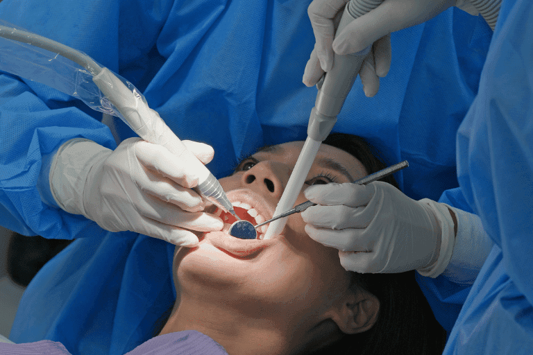 Root Canal Treatment at Smile Lounge