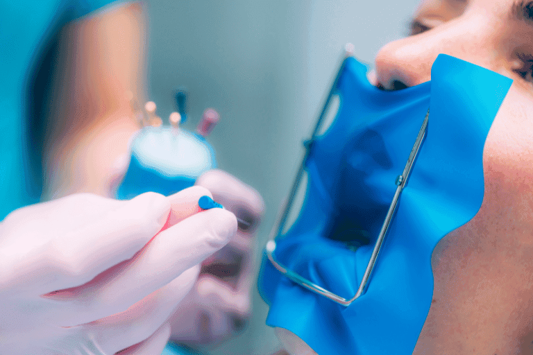 Root Canal Treatment at Smile Lounge